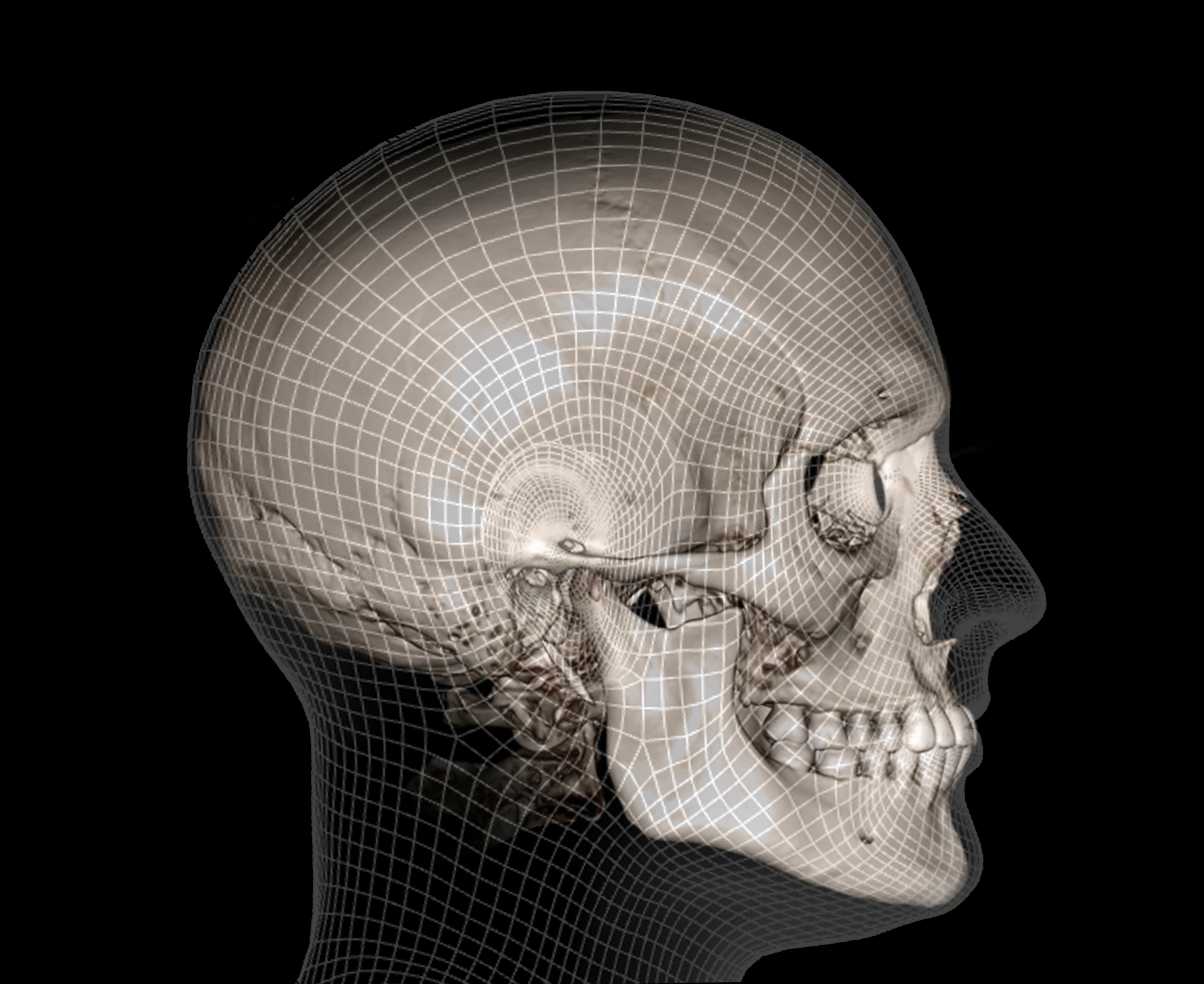 디지털 구강스캔 3D CT 스캔